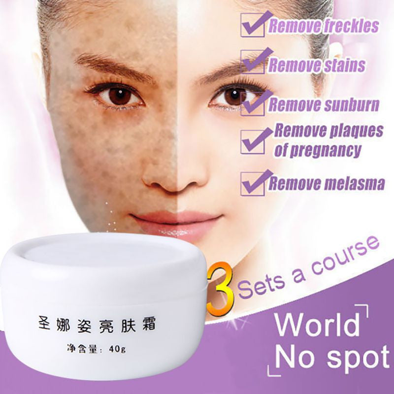 SnazII Moisturize whitening repair fade spot facial cream,eliminate melanin,facial care treatment,purifying freckle