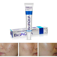 30g Aloe Plant Extract Acne Scar Remove Whitening Antibacterial Ointment Face Skin Care Cream