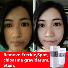 Fade Dark Spots Face Mask Whitening and Spot Removal Products Moisturizing Exfoliator Anti Wrinkle Skin Care Masks 40g