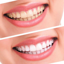 Teeth Whitening 44% Peroxide Dental Bleaching System Oral Gel Kit Tooth Whitener Dental Equipment