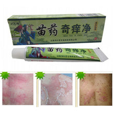 Net Herbal Itch Cream Fungal Infections Foot And Ringworm Balanitis Hemorrhoids Anti-itch Body Creams