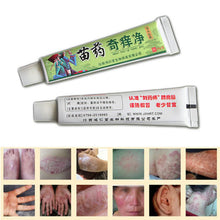 Net Herbal Itch Cream Fungal Infections Foot And Ringworm Balanitis Hemorrhoids Anti-itch Body Creams