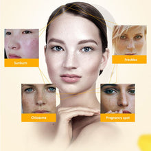 New Women Face Skin Whitening Remove Freckle Speckle Peel Dark Spot Wrinkles Cream