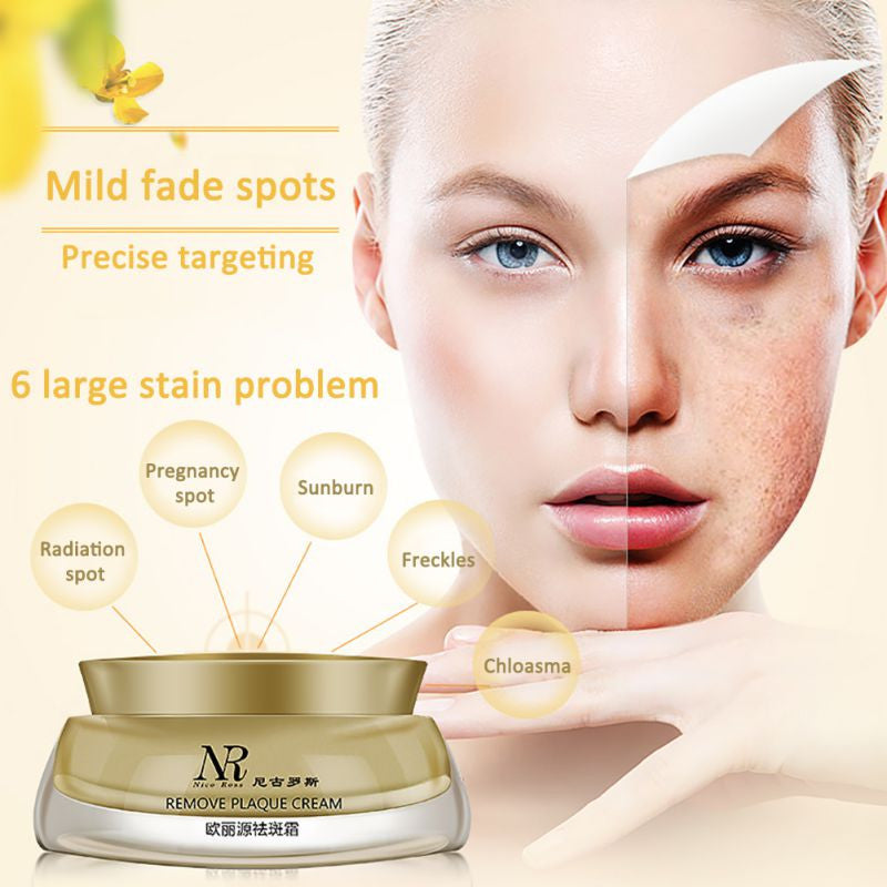 New Women Face Skin Whitening Remove Freckle Speckle Peel Dark Spot Wrinkles Cream