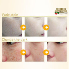 New Women Face Skin Whitening Remove Freckle Speckle Peel Dark Spot Wrinkles Cream