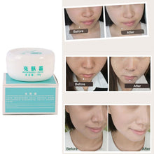 Powerful whitening Freckle cream Remove melasma Acne Spots pigment Melanin face care cream L4